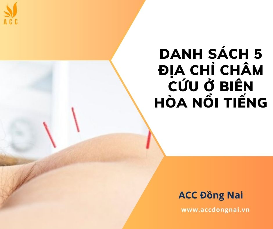 Danh sách 5 địa chỉ châm cứu ở Biên Hòa nổi tiếng