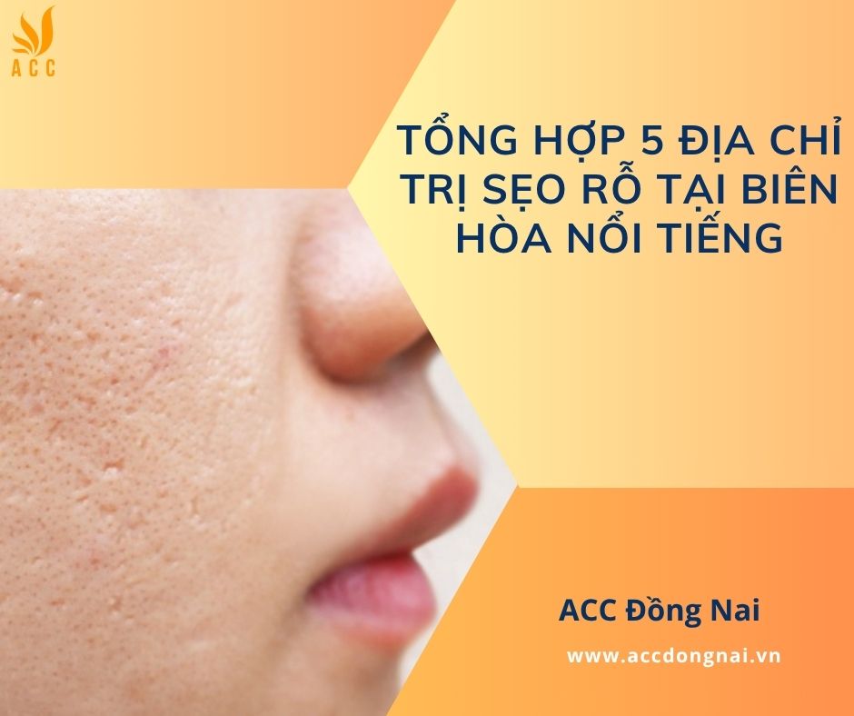 Tổng hợp 5 địa chỉ trị sẹo rỗ tại Biên Hòa nổi tiếng